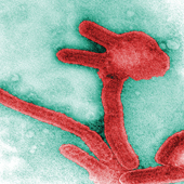 Marburg Virus (Photo Credit: Frederick Murphy)